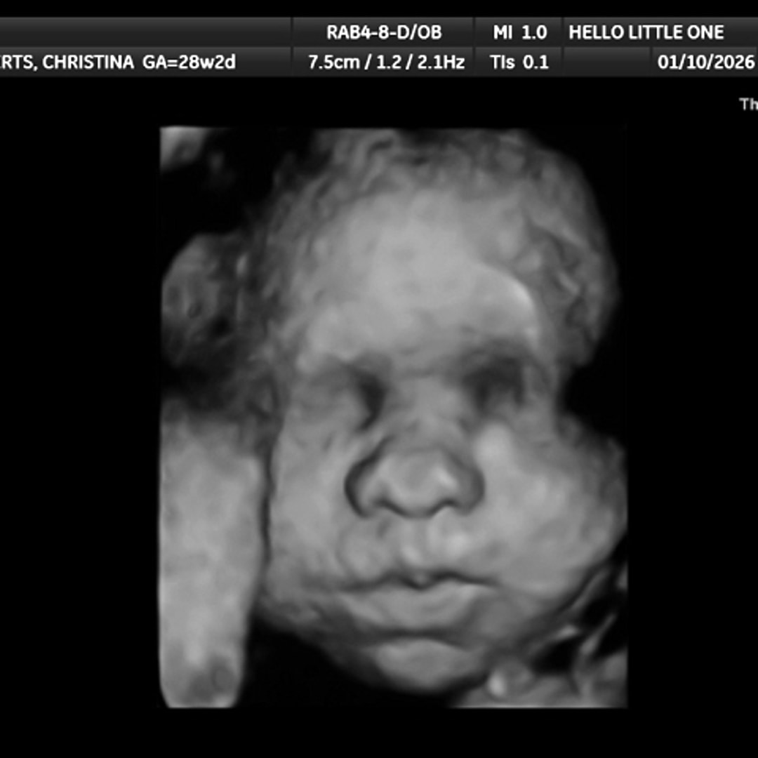 Photo shared by Christina for their Babylist baby registry.