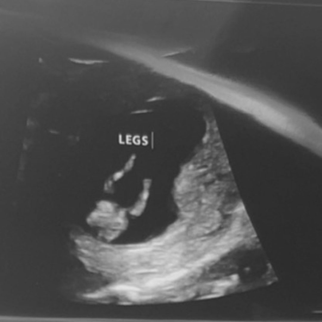 Photo shared by Hannah for their Babylist baby registry.