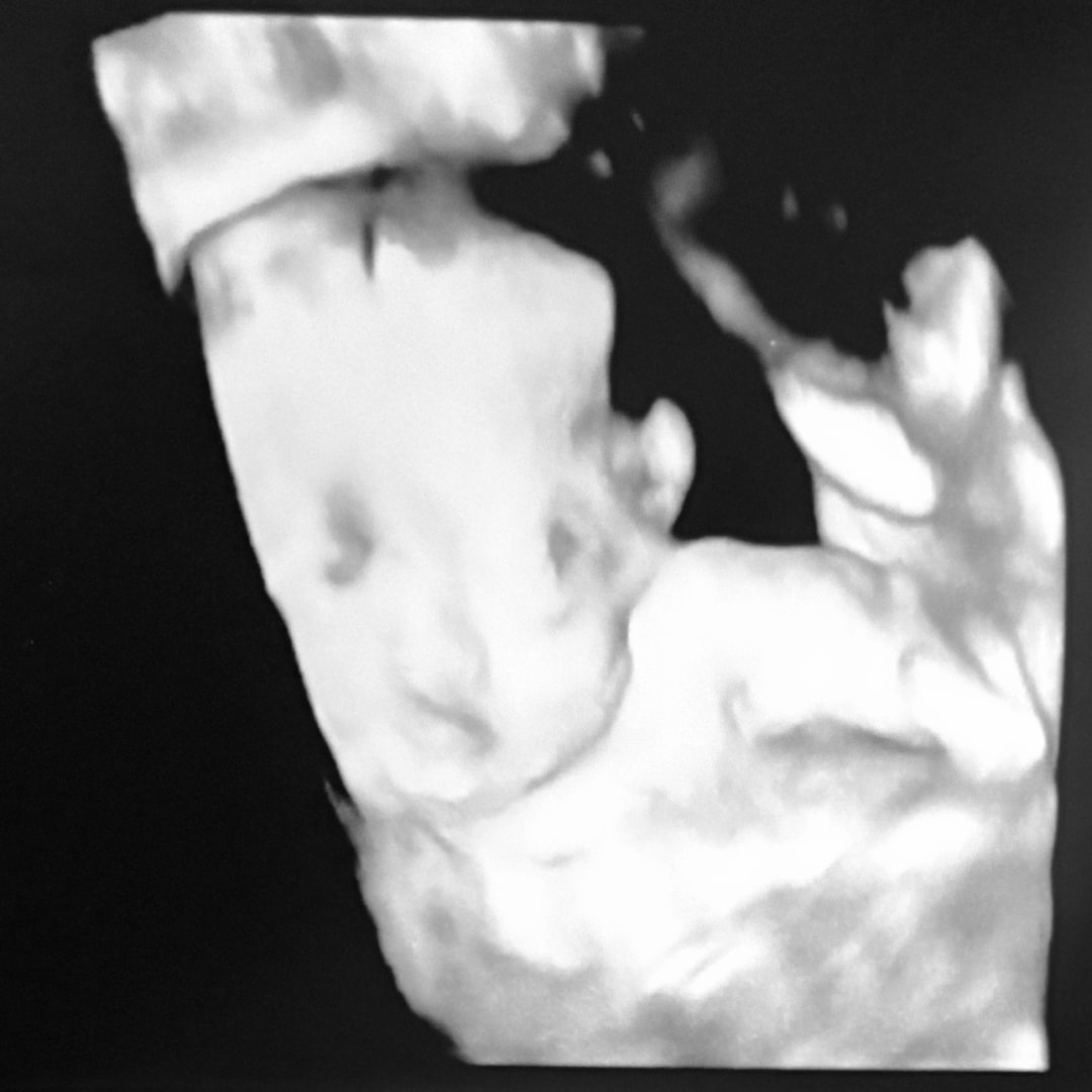 Photo shared by Tiffany for their Babylist baby registry.