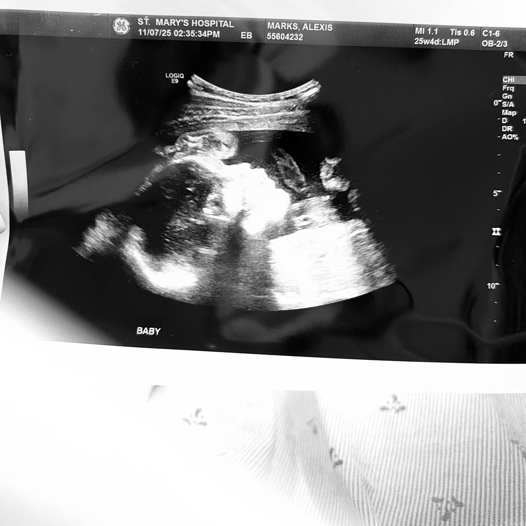 Photo shared by Alexis for their Babylist baby registry.