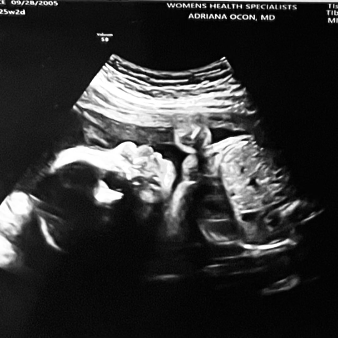 Photo shared by Dulce for their Babylist baby registry.