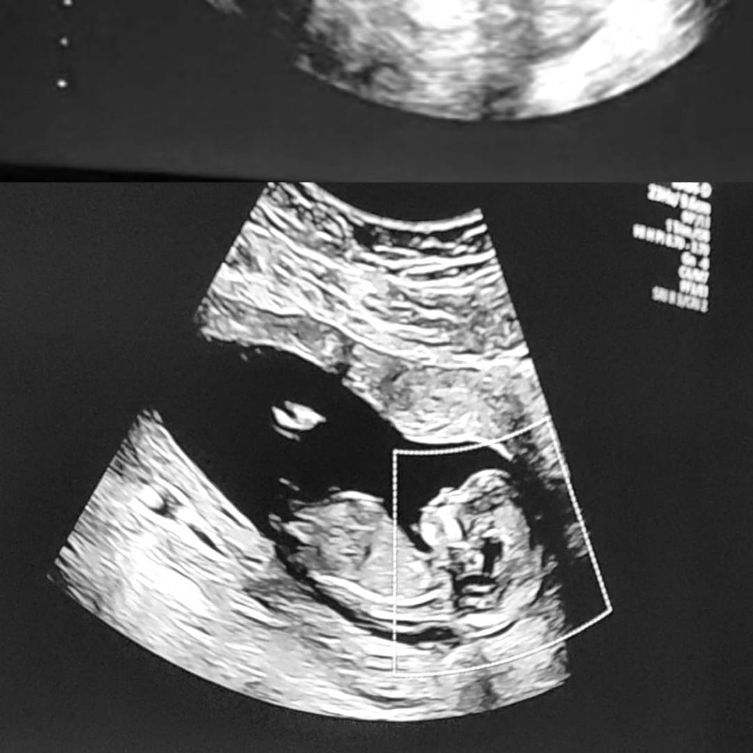 Photo shared by Leslie for their Babylist baby registry.