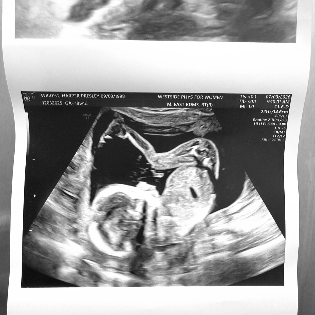Photo shared by Harper for their Babylist baby registry.