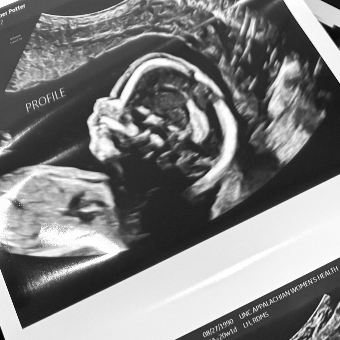 Photo shared by Amber for their Babylist baby registry.