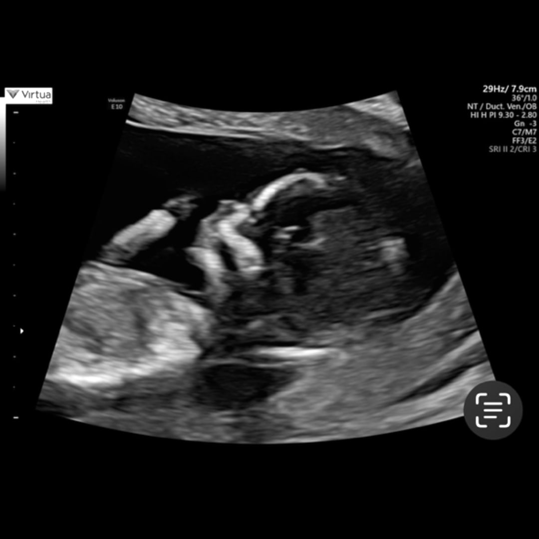 Photo shared by Joy for their Babylist baby registry.