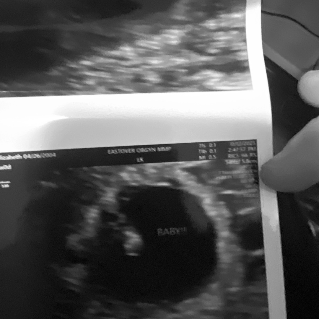 Photo shared by Savannah for their Babylist baby registry.