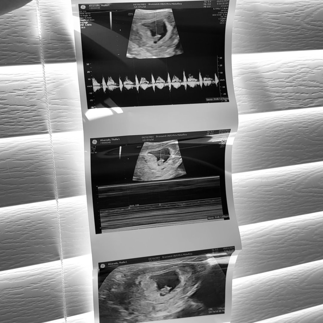 Photo shared by Thalia for their Babylist baby registry.