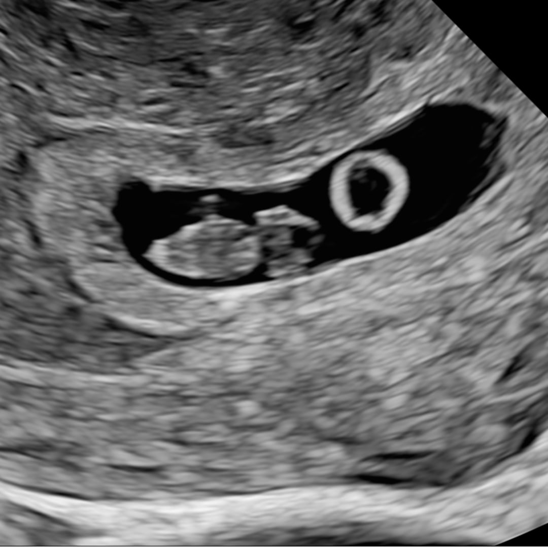 Photo shared by Erin for their Babylist baby registry.