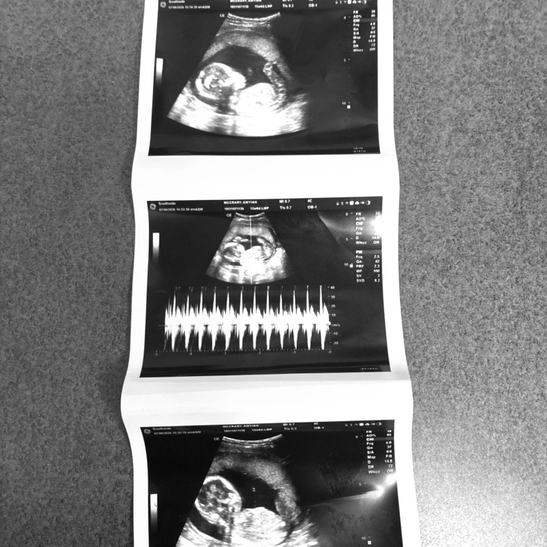 Photo shared by Amyiah for their Babylist baby registry.