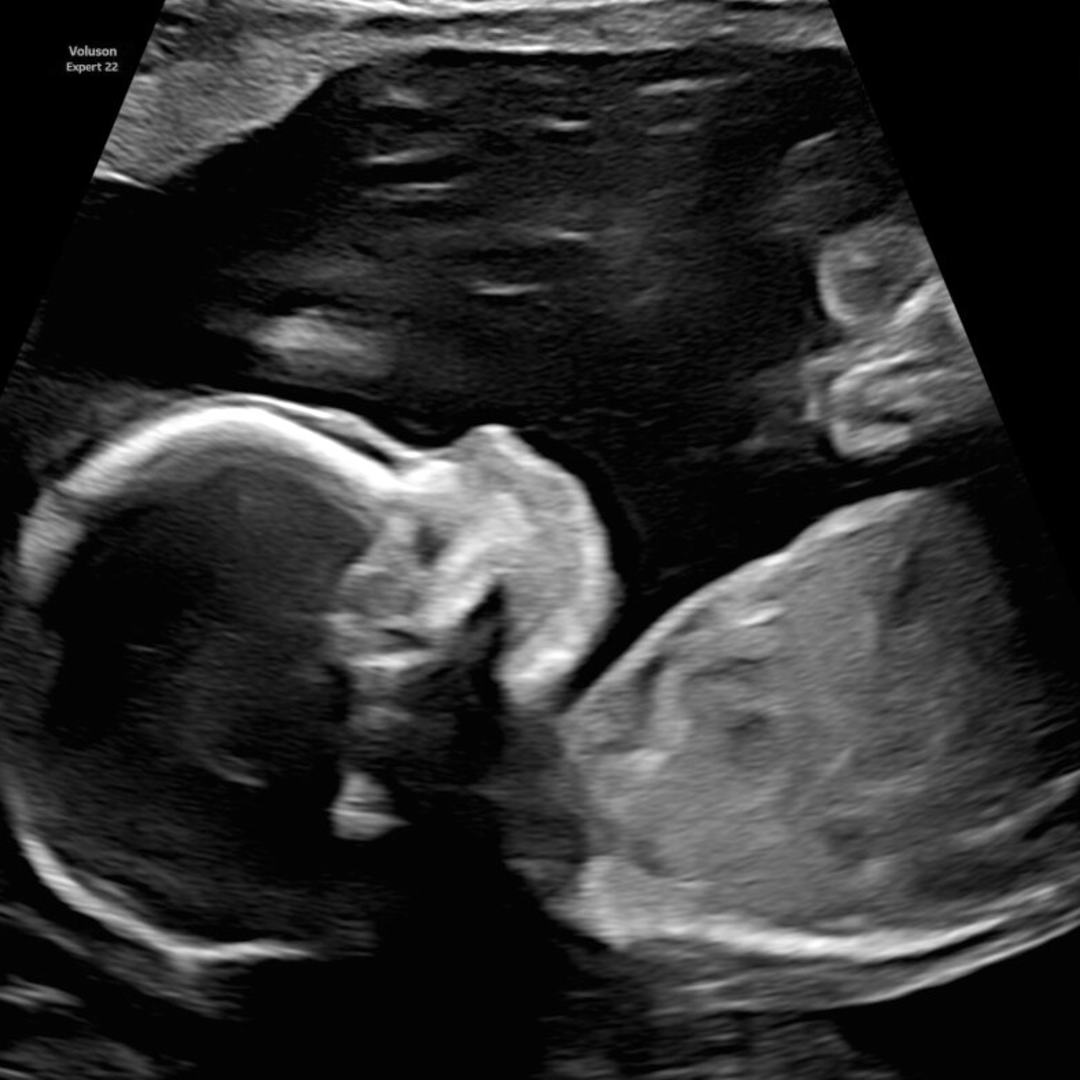 Photo shared by Sara for their Babylist baby registry.