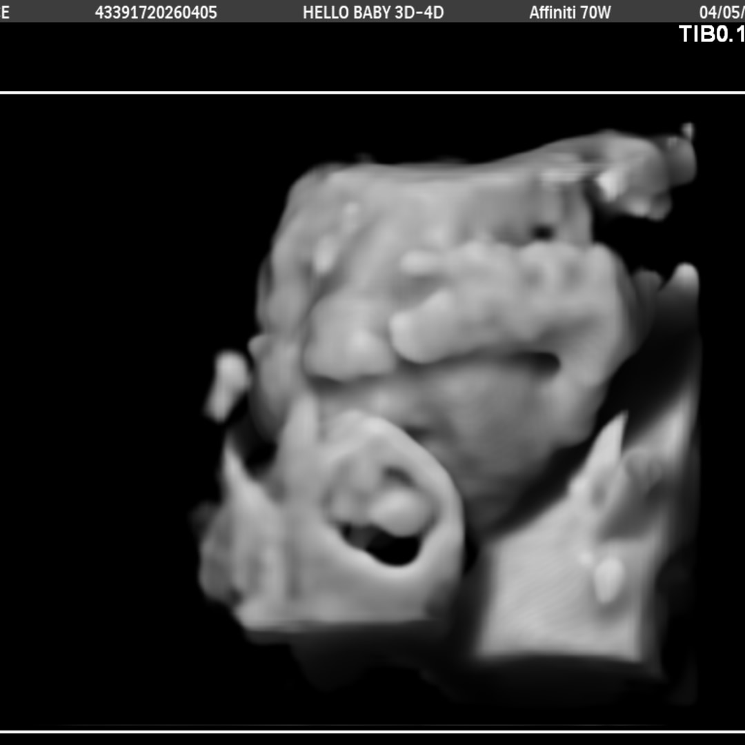 Photo shared by Candice for their Babylist baby registry.