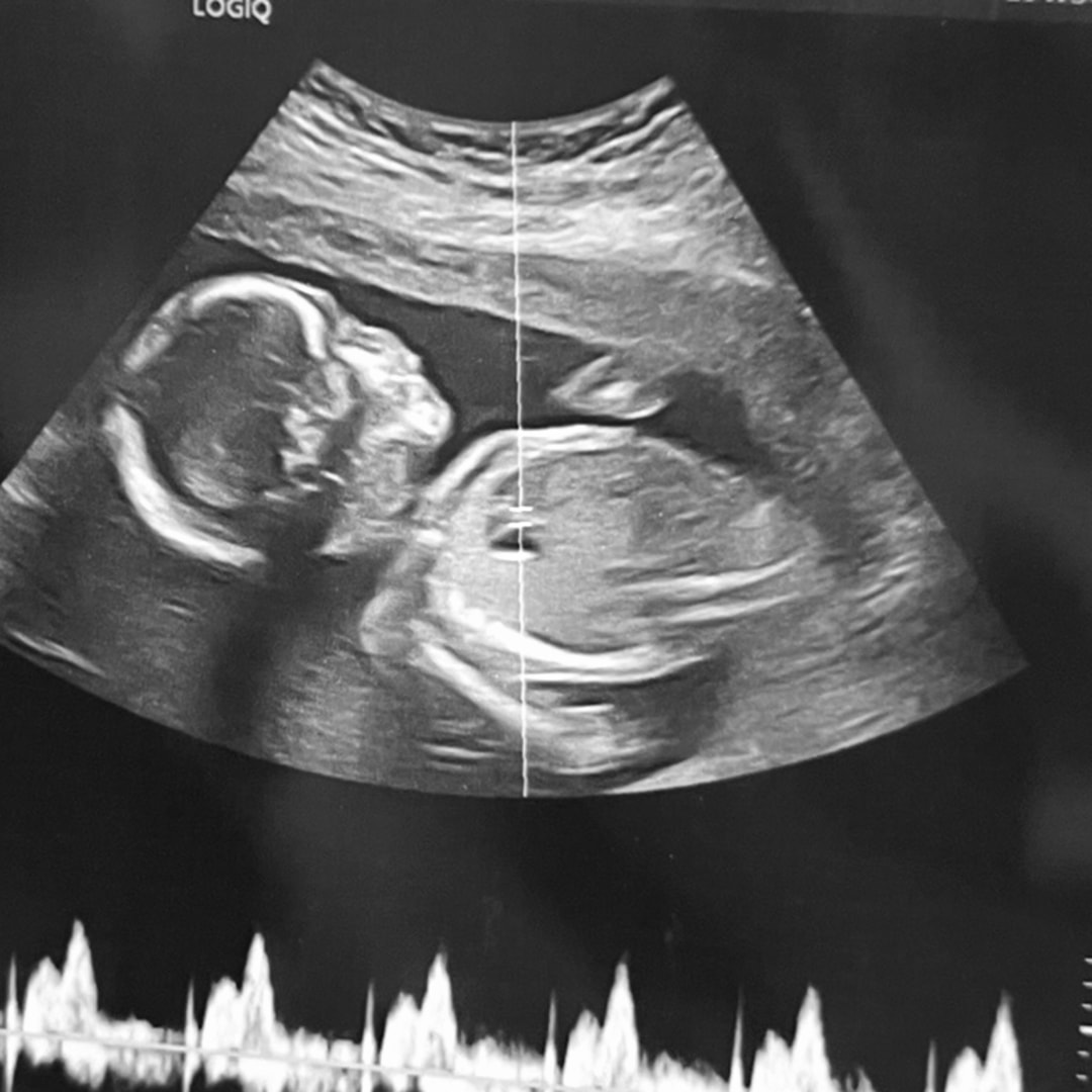 Photo shared by Shaena for their Babylist baby registry.