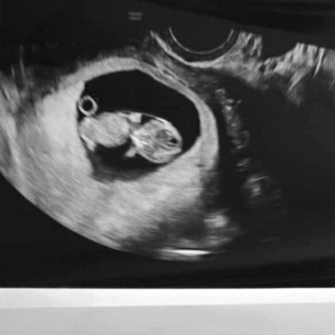 Photo shared by Danielle for their Babylist baby registry.