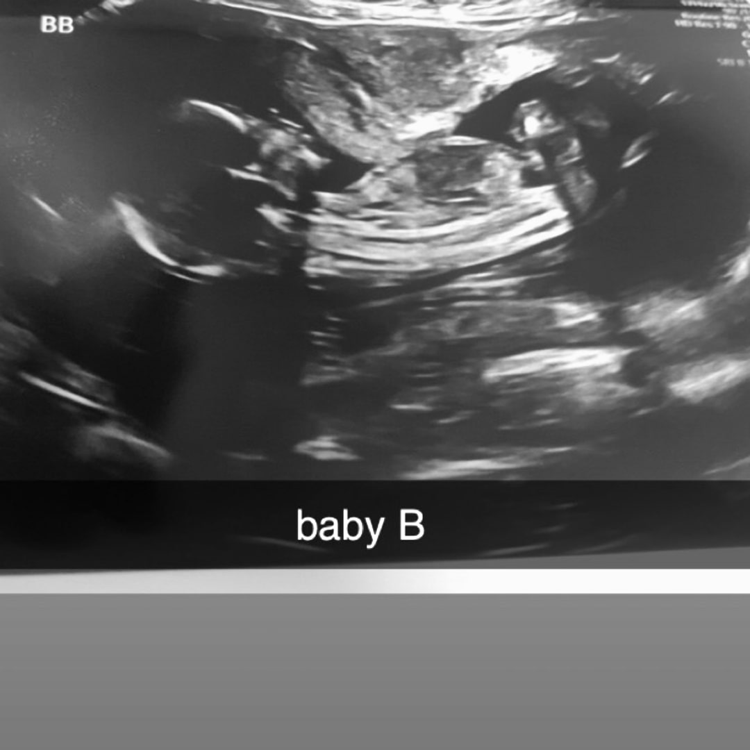 Photo shared by Tahlia for their Babylist baby registry.