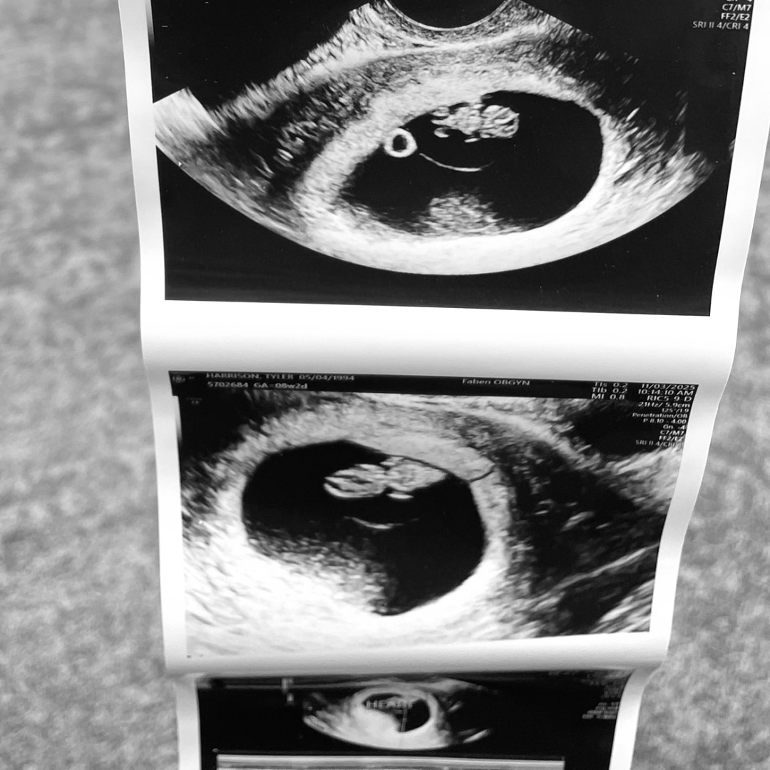 Photo shared by Tyler for their Babylist baby registry.