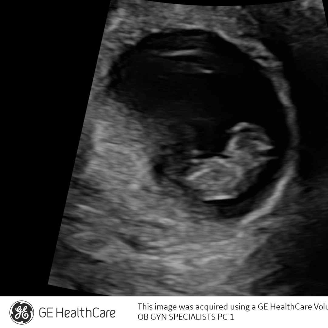 Photo shared by Jess for their Babylist baby registry.