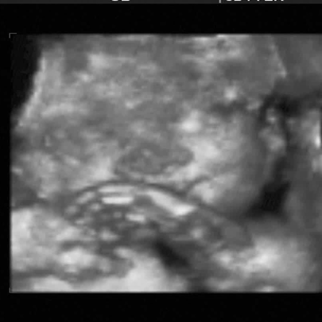 Photo shared by Lizette for their Babylist baby registry.