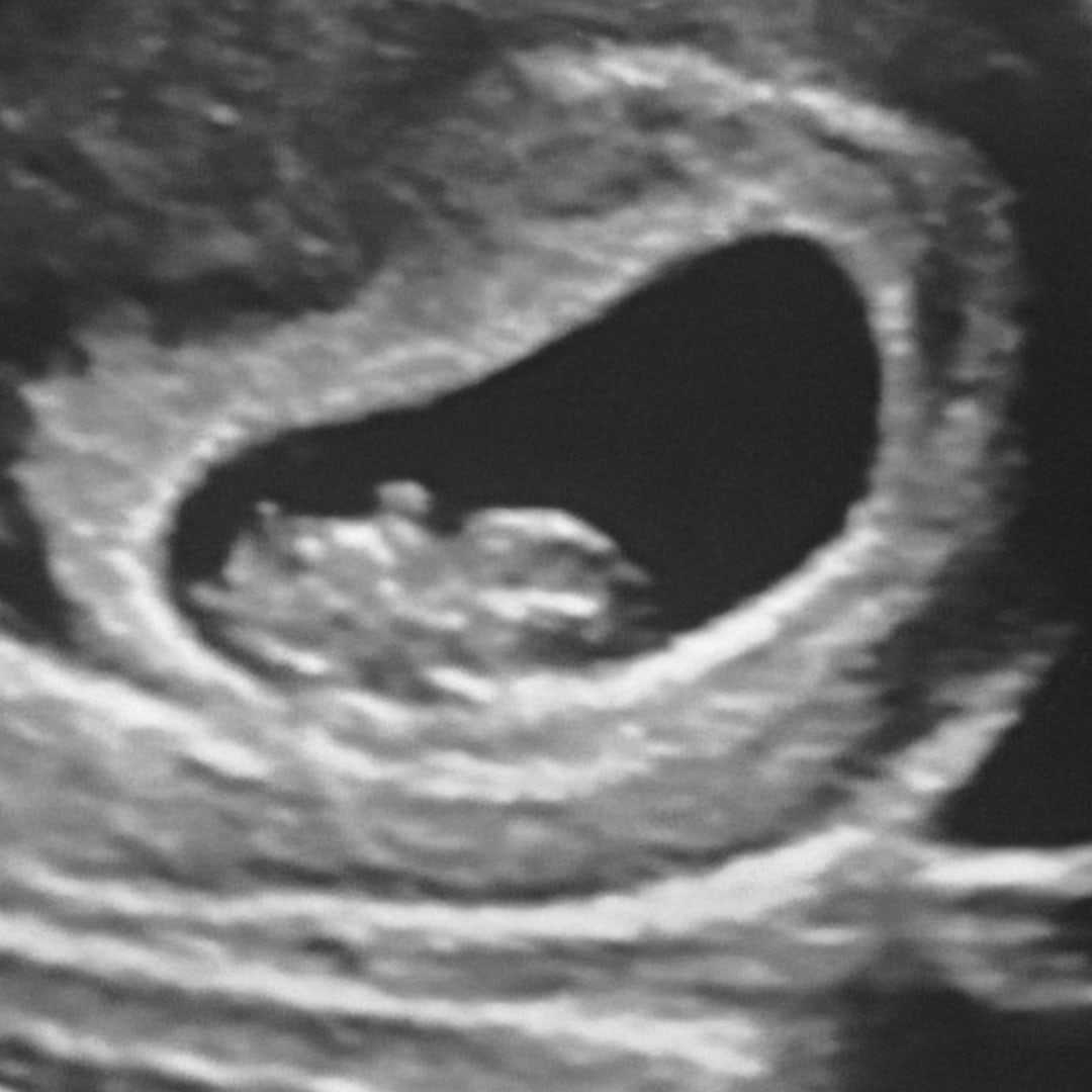 Photo shared by Lauren for their Babylist baby registry.