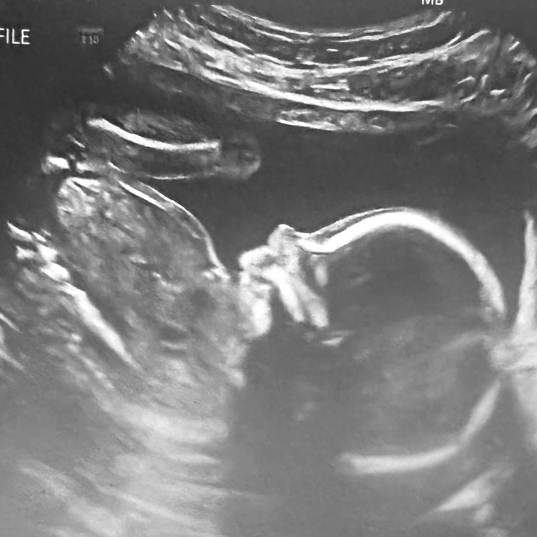 Photo shared by Linnaea for their Babylist baby registry.