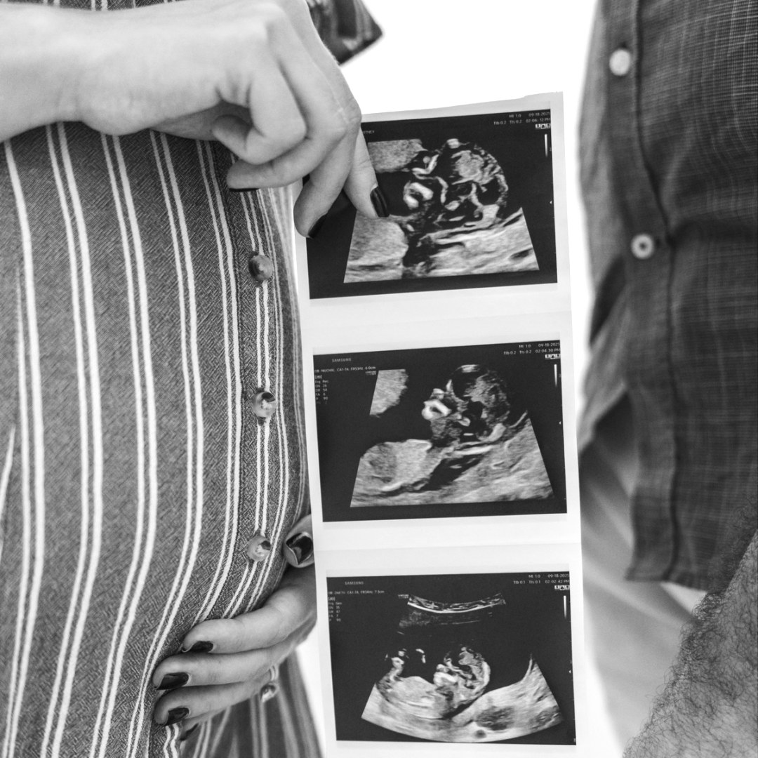 Photo shared by Courtney for their Babylist baby registry.