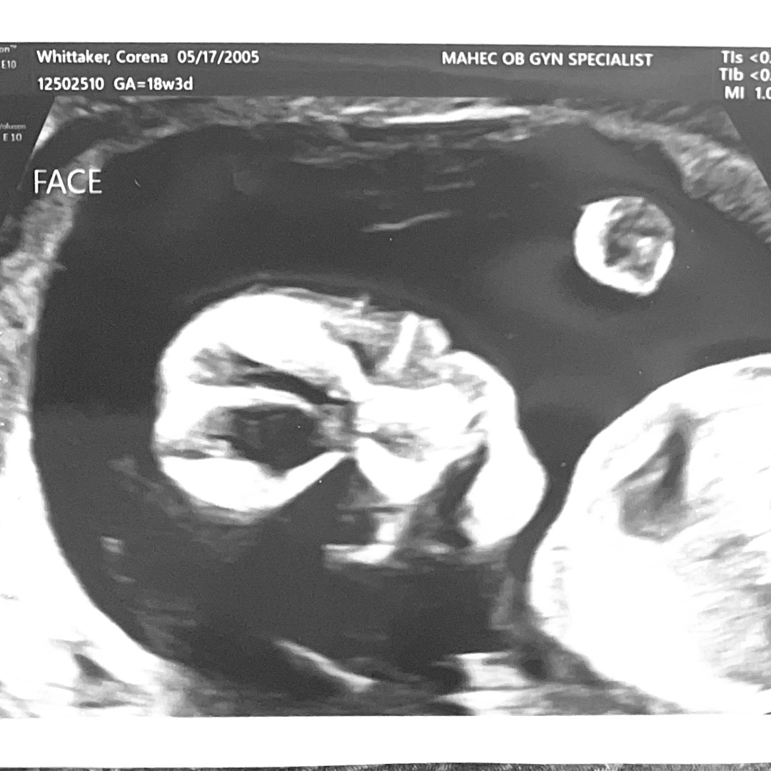 Photo shared by Corena for their Babylist baby registry.