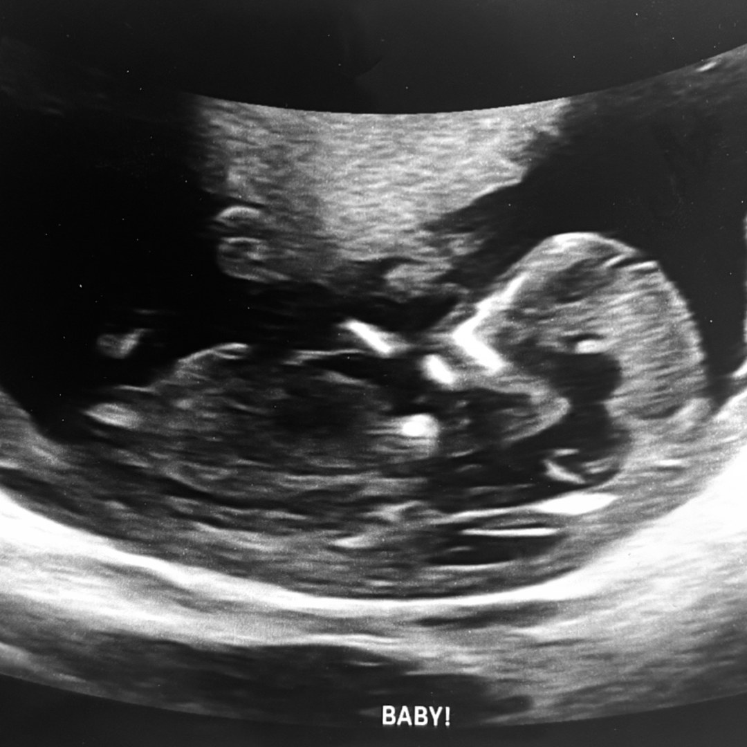 Photo shared by Alyssa for their Babylist baby registry.