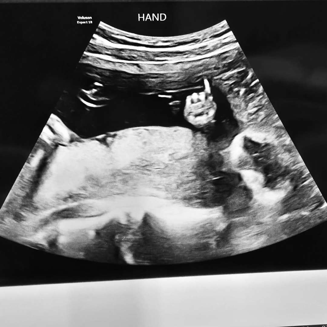 Photo shared by Bryan for their Babylist baby registry.