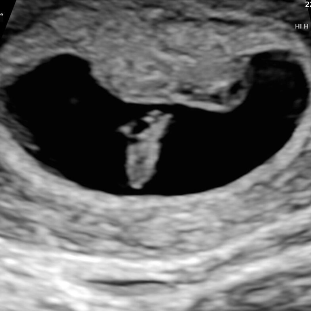 Photo shared by Kallie for their Babylist baby registry.