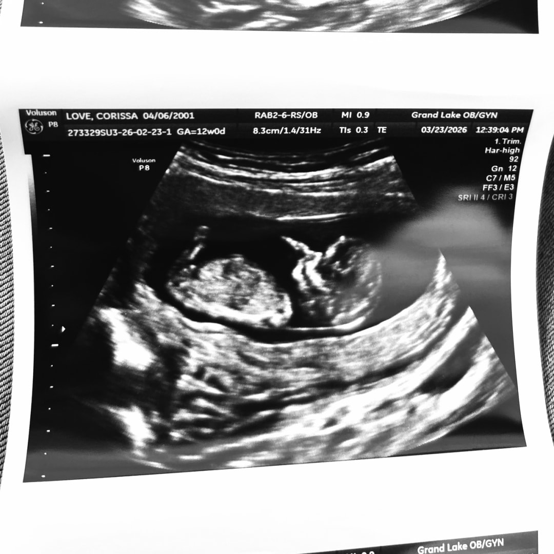 Photo shared by Corissa for their Babylist baby registry.