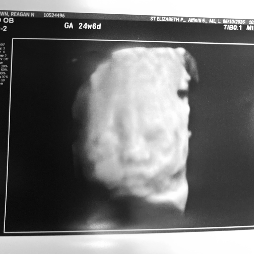 Photo shared by Reagan for their Babylist baby registry.