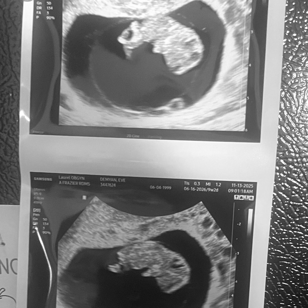 Photo shared by Eve for their Babylist baby registry.