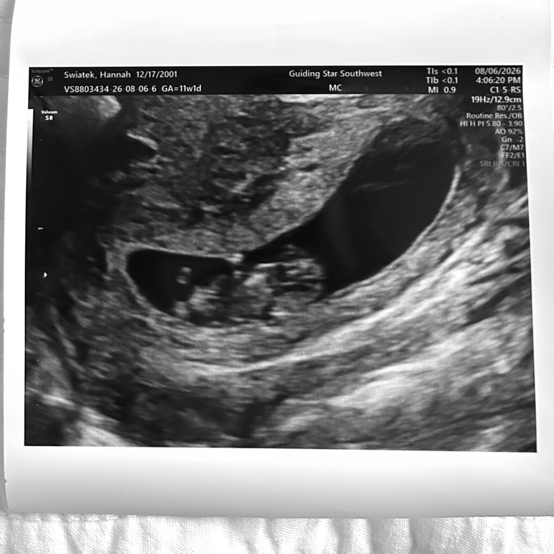 Photo shared by Hannah for their Babylist baby registry.