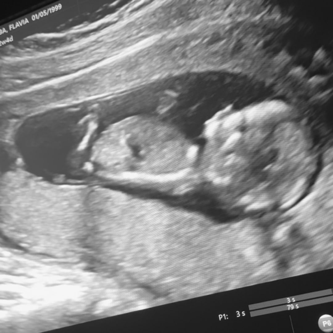 Photo shared by Flavia for their Babylist baby registry.