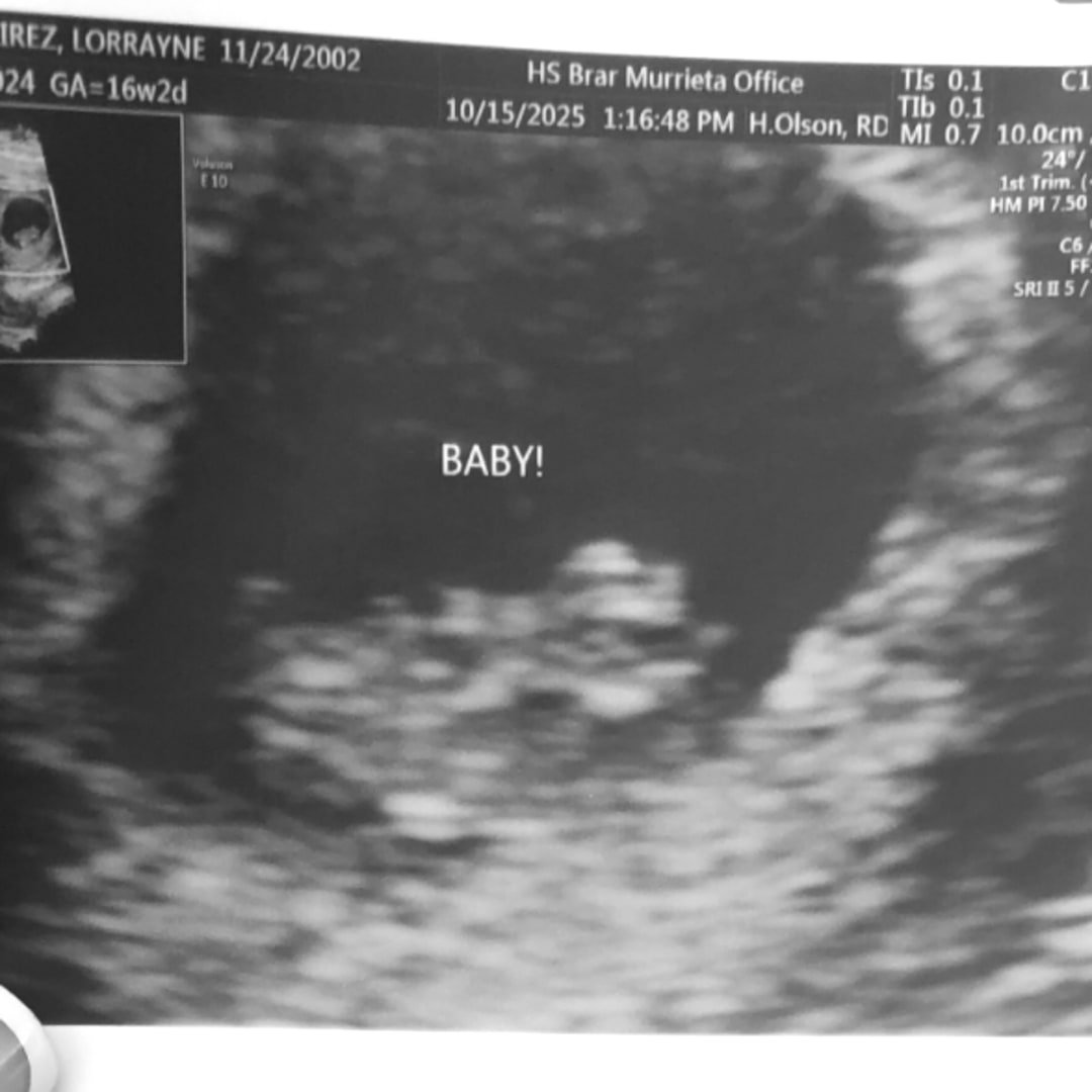 Photo shared by Lorrayne for their Babylist baby registry.