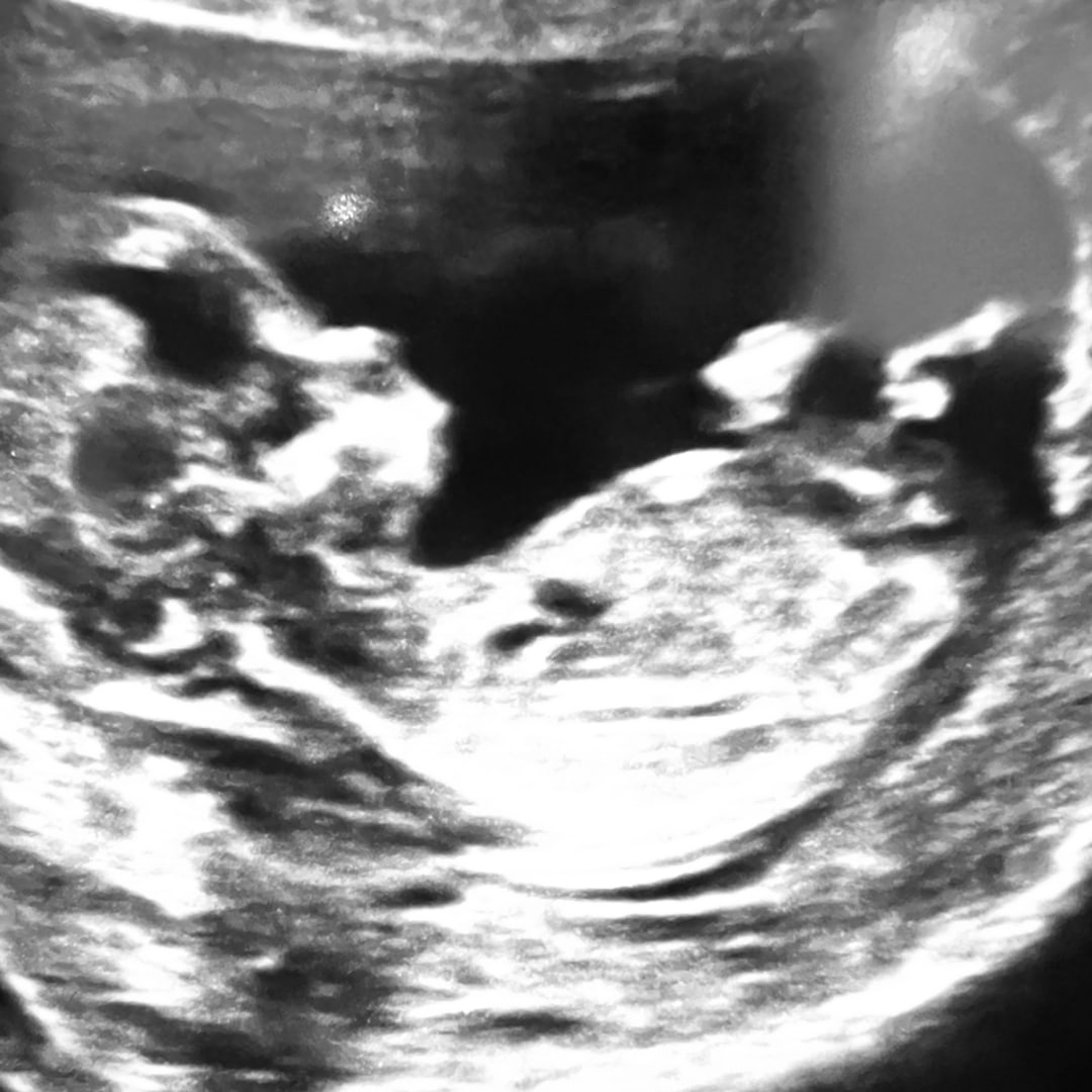 Photo shared by Vicky for their Babylist baby registry.