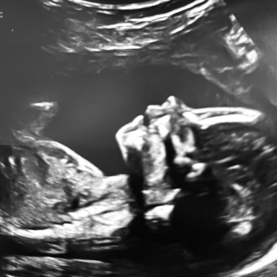 Photo shared by Mandy for their Babylist baby registry.