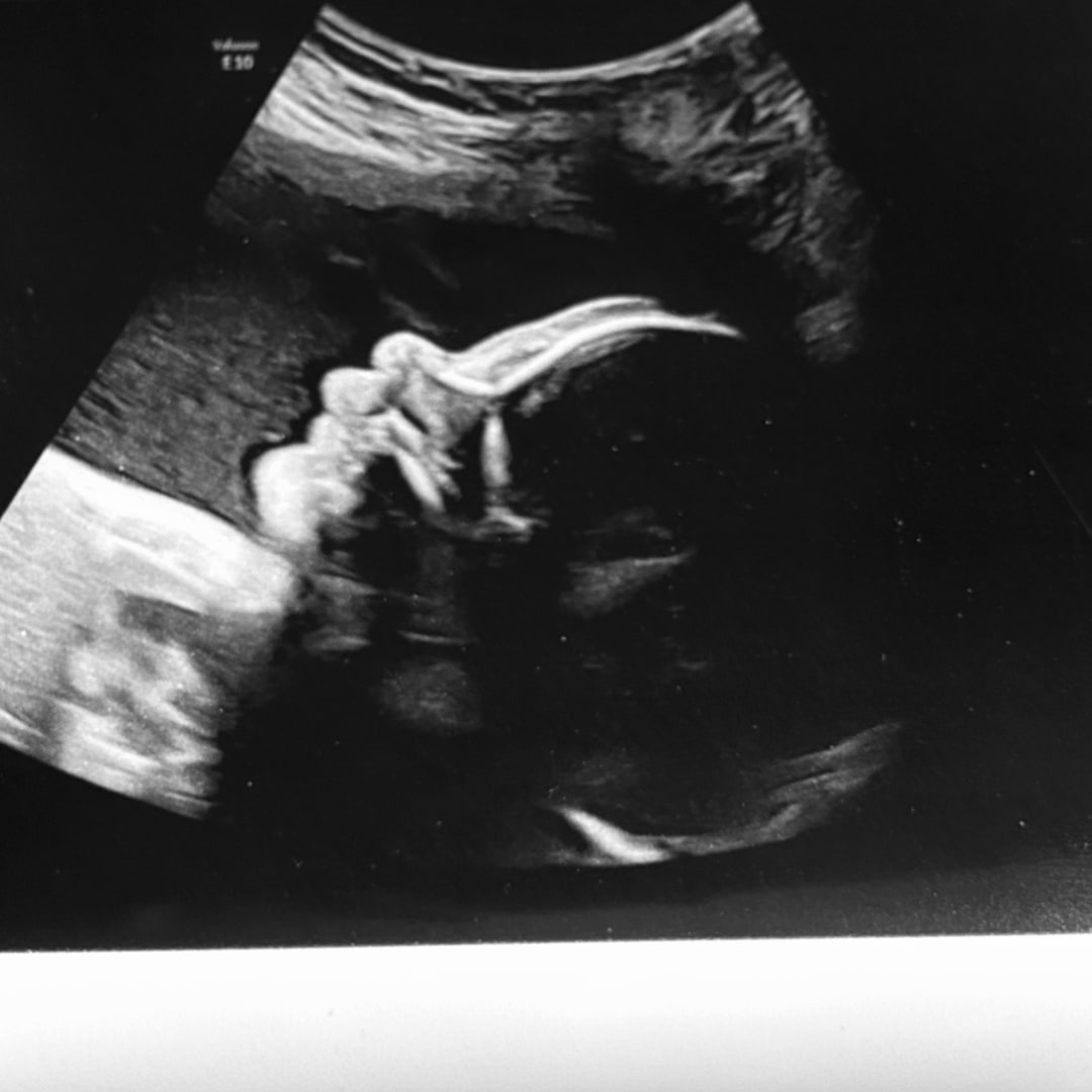 Photo shared by Skylar for their Babylist baby registry.