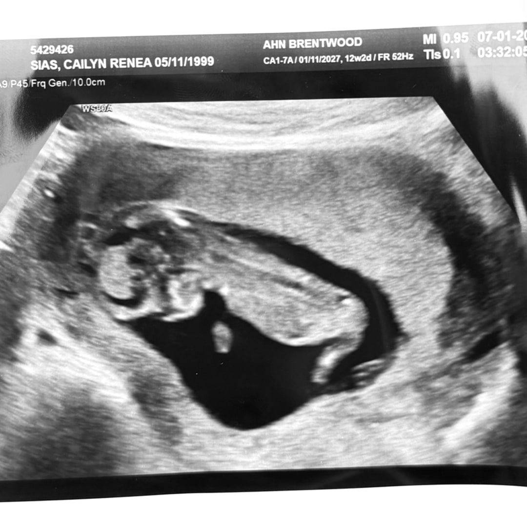 Photo shared by Cailyn for their Babylist baby registry.