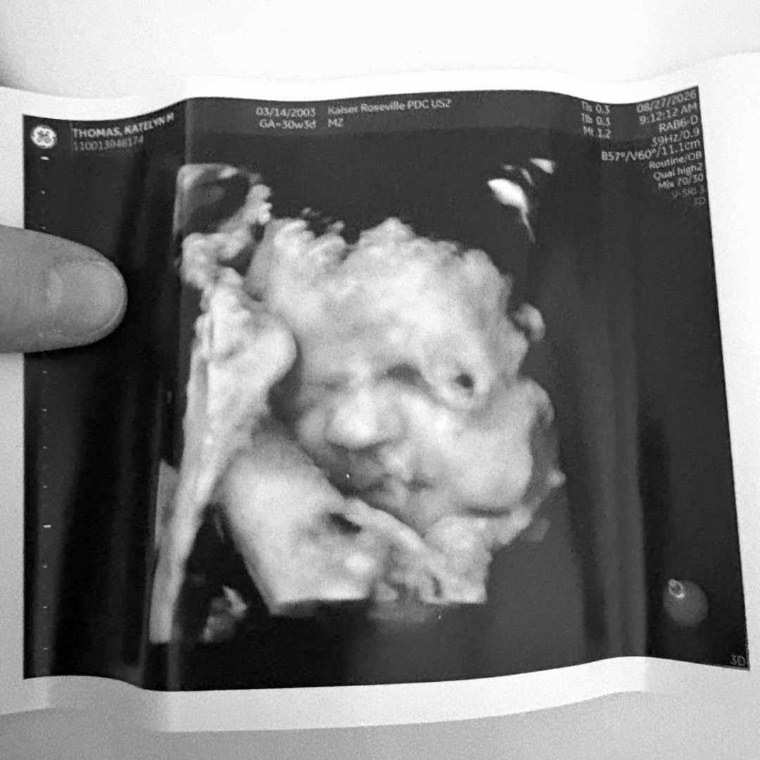 Photo shared by Katie for their Babylist baby registry.