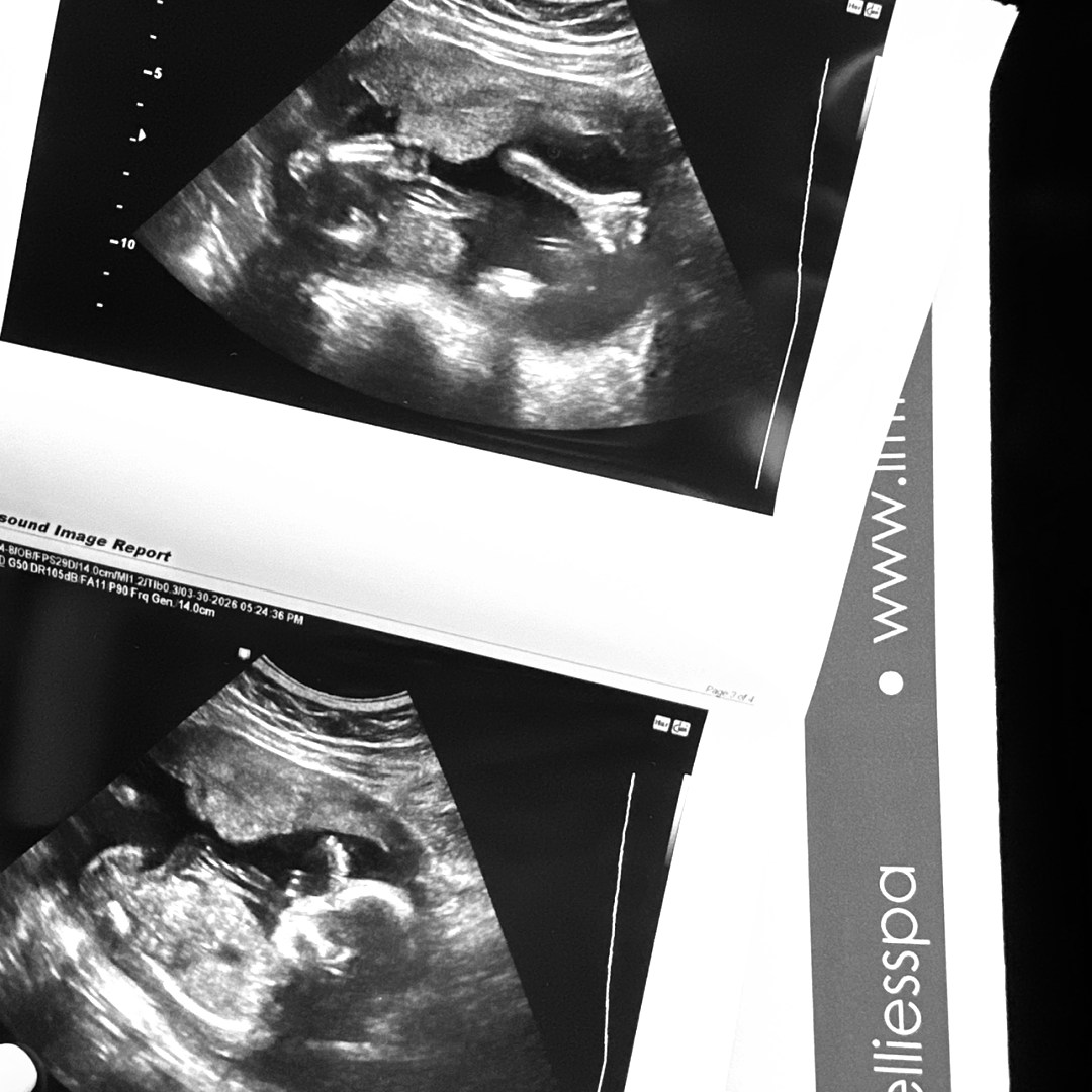 Photo shared by Sierra for their Babylist baby registry.