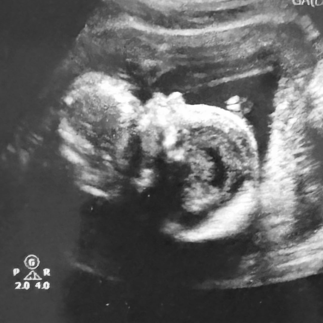 Photo shared by Lexi for their Babylist baby registry.