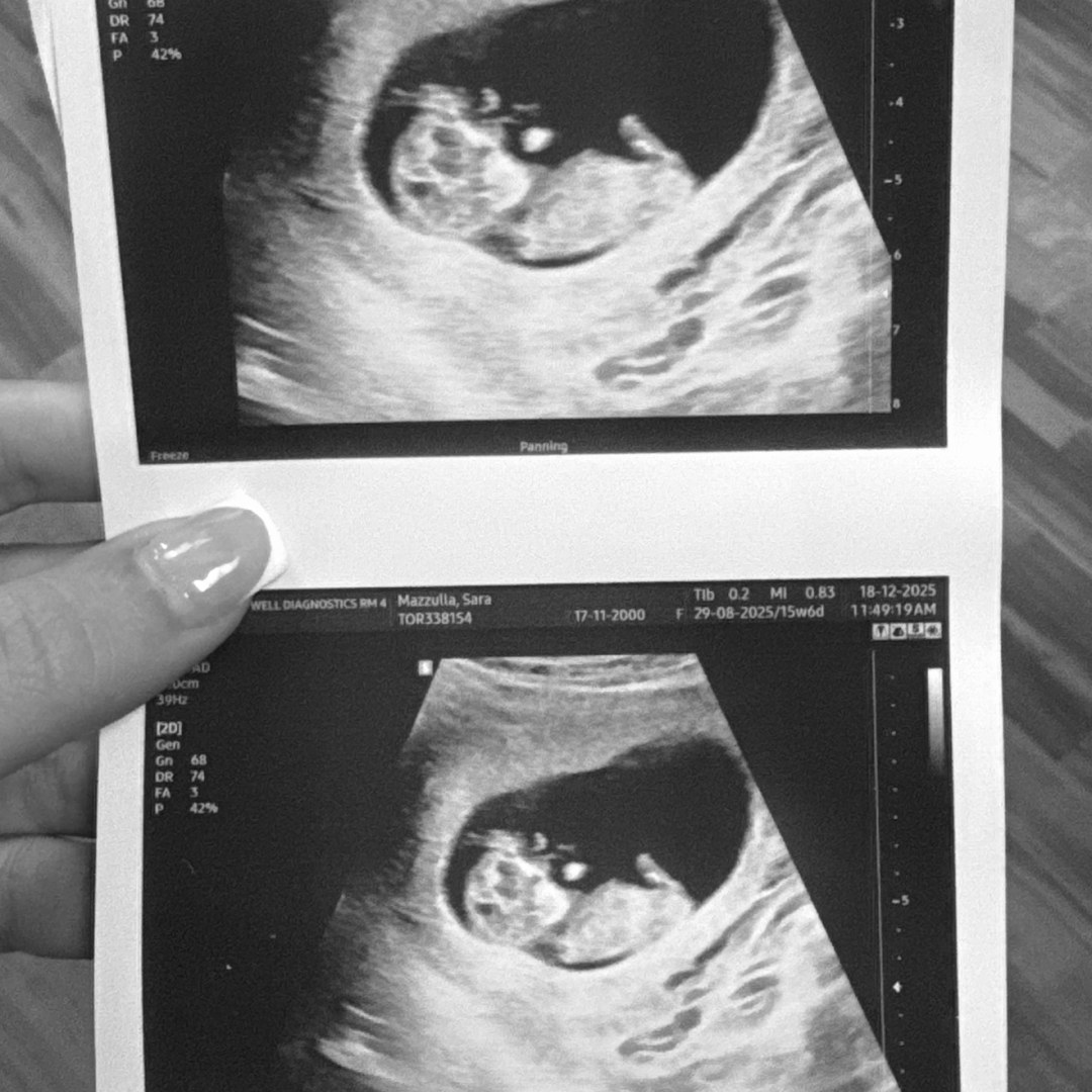 Photo shared by Sara for their Babylist baby registry.