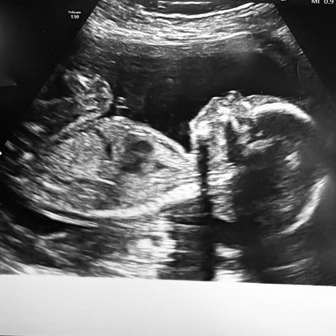 Photo shared by Julie for their Babylist baby registry.