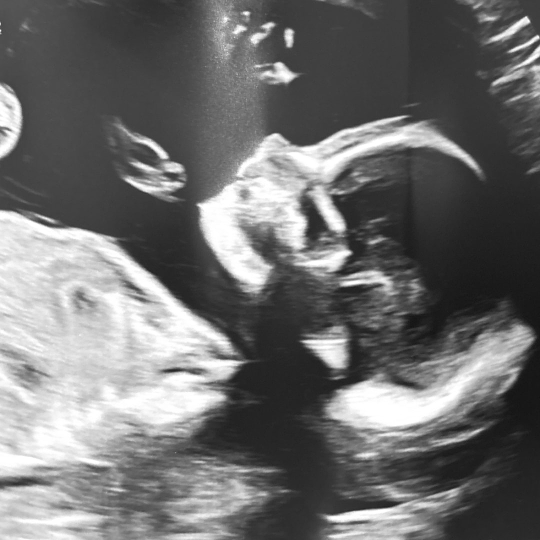 Photo shared by Katie for their Babylist baby registry.