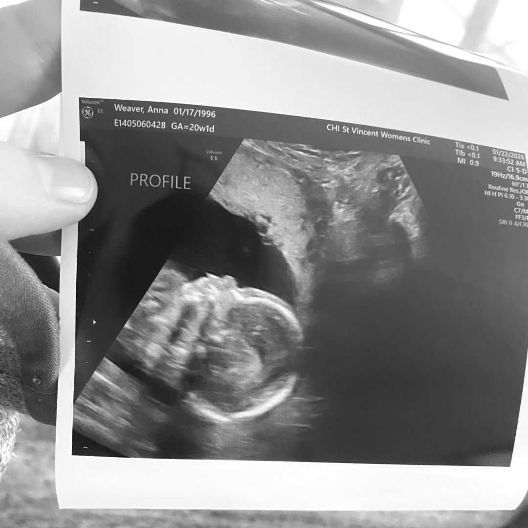 Photo shared by Annie for their Babylist baby registry.