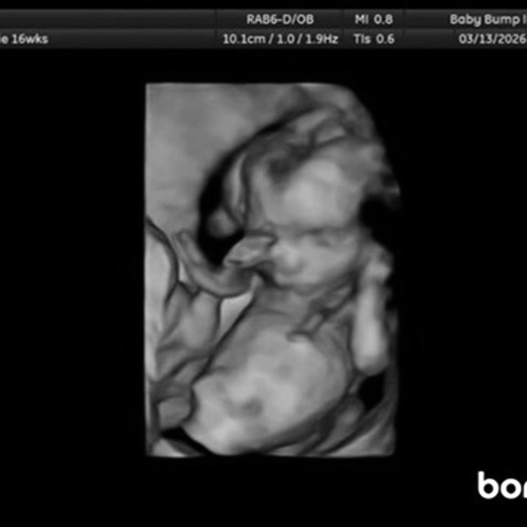 Photo shared by Allie for their Babylist baby registry.