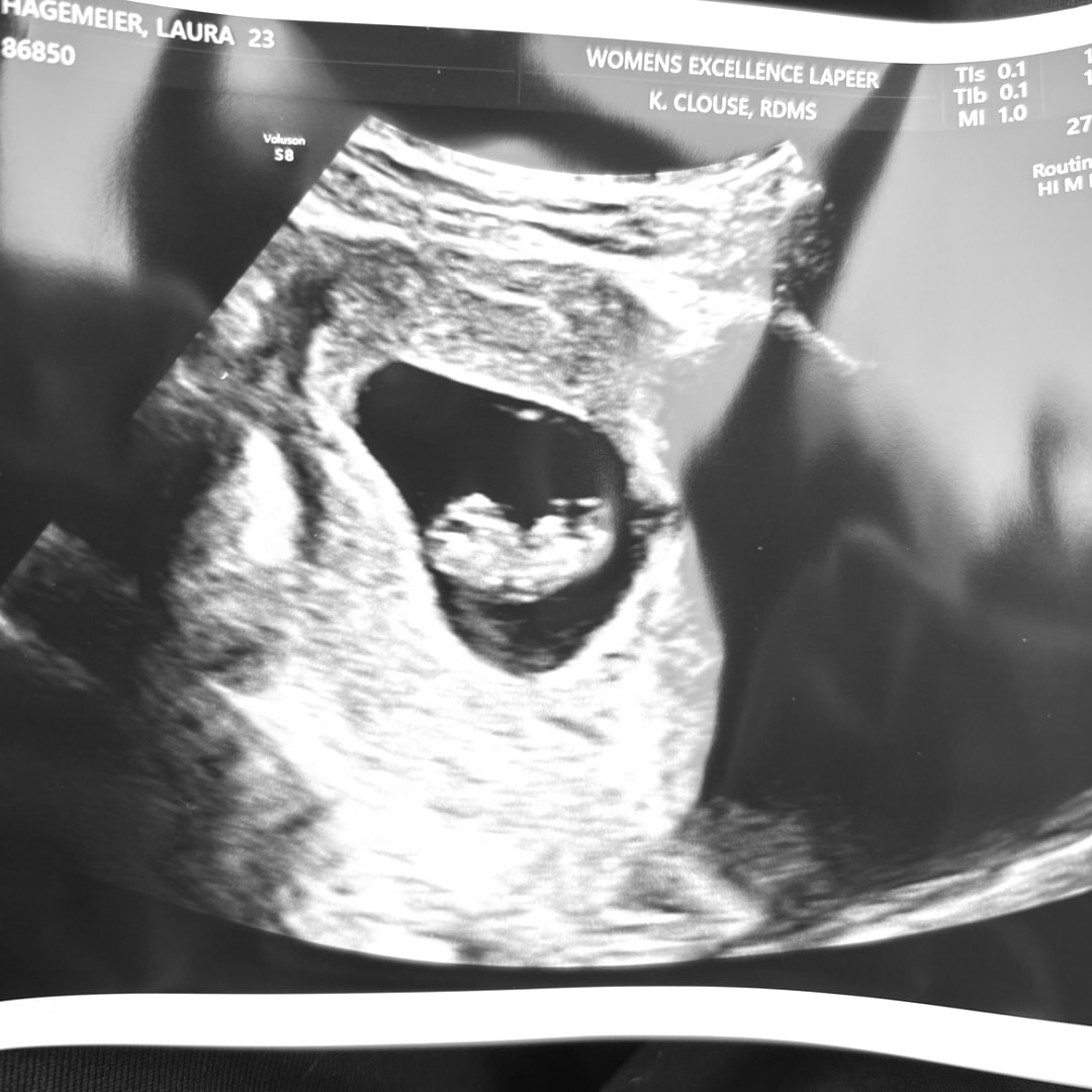 Photo shared by Laura for their Babylist baby registry.