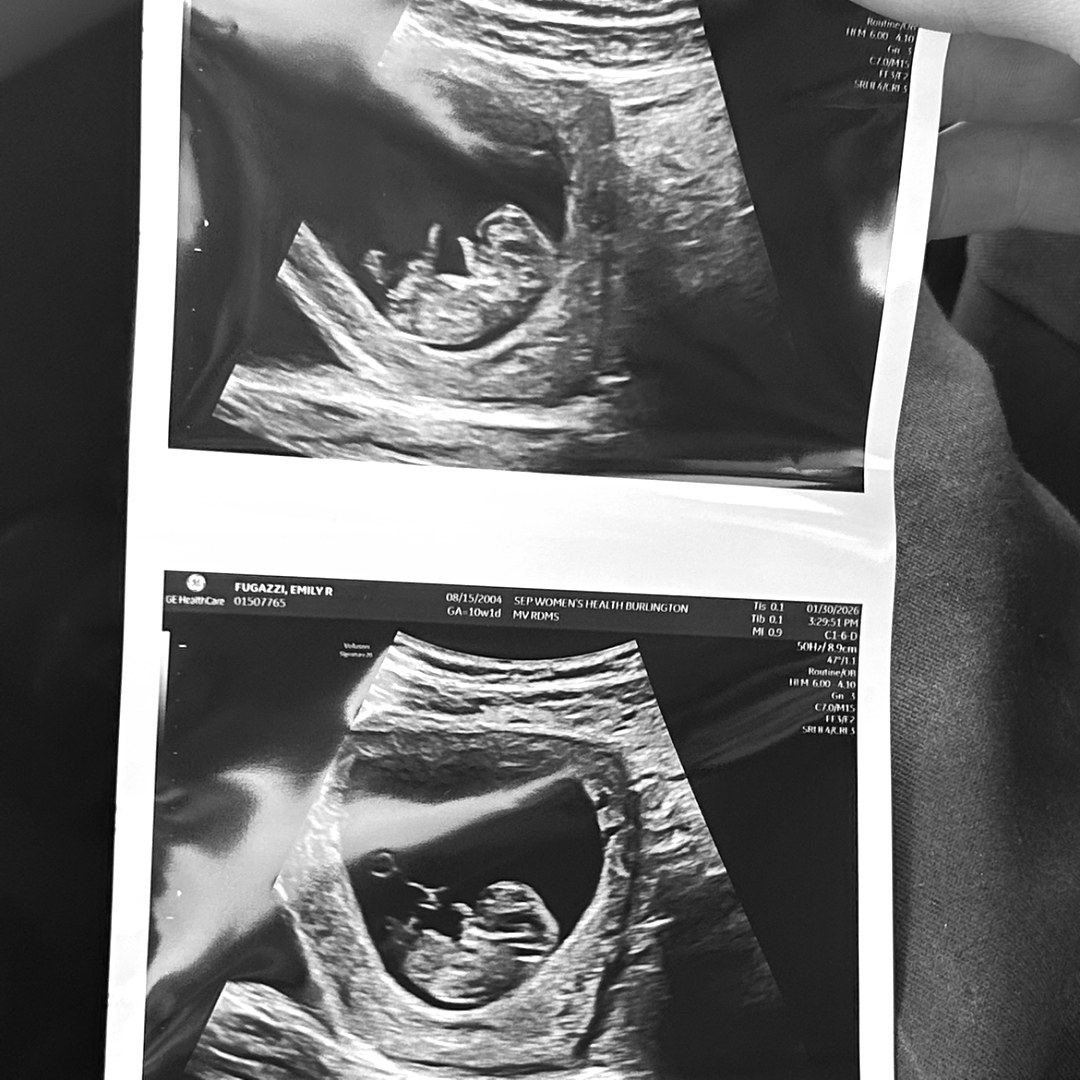 Photo shared by Emily for their Babylist baby registry.