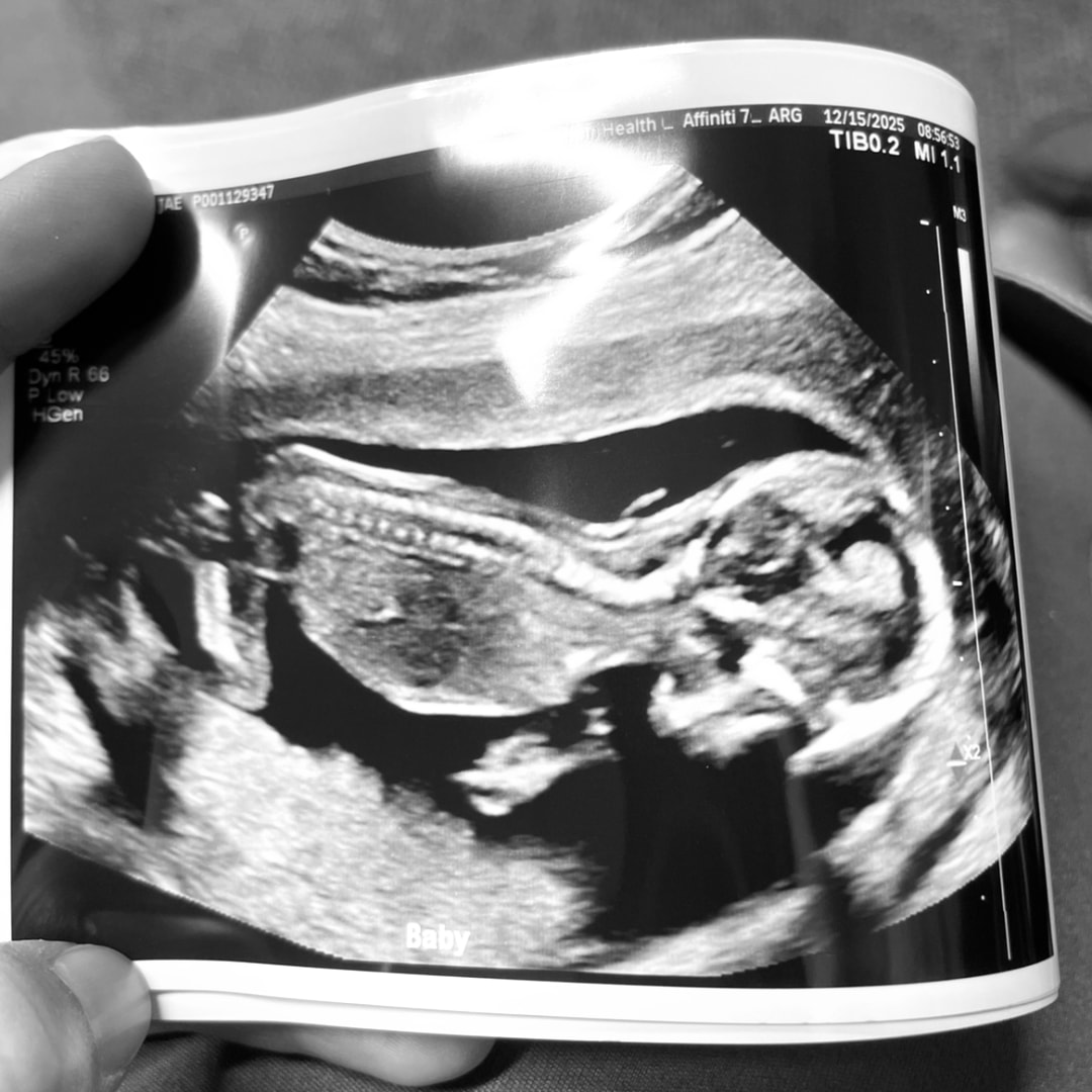 Photo shared by Abbigail for their Babylist baby registry.