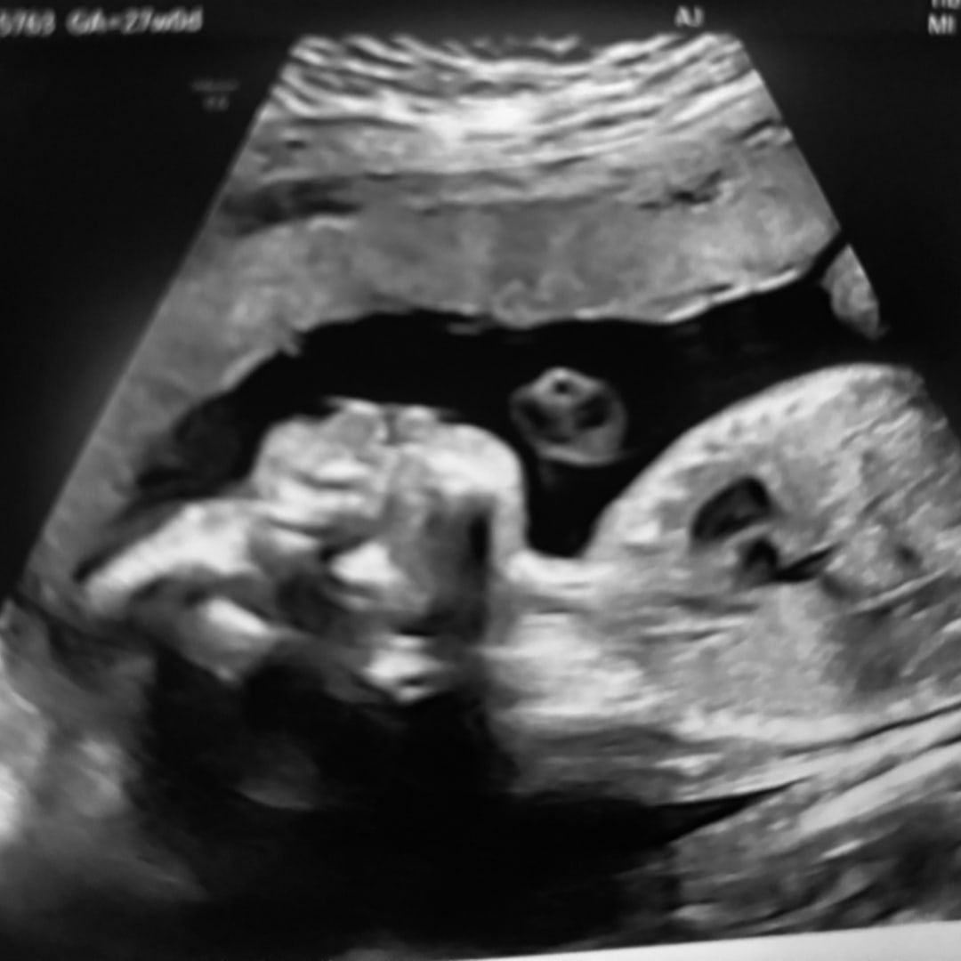 Photo shared by Darniesha for their Babylist baby registry.